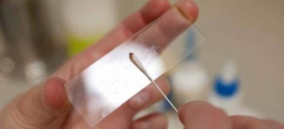 Odstranjevanje jajčec črvov